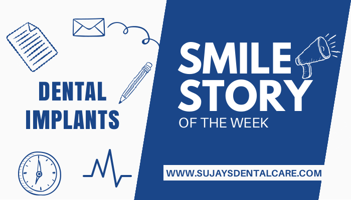 Full mouth rehabilitation using dental implants