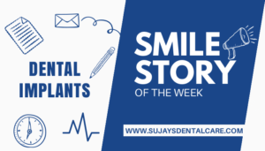 Dental Implants cover image smile story