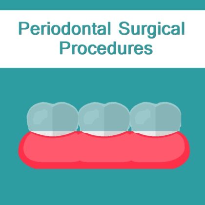Periodontal Surgical Procedures logo