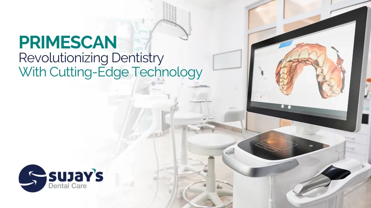 Primescan intraoral scanner capturing detailed 3D images